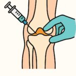 Joint Injection/Aspiration (large joint) procedure thumbnail