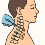 Minimally invasive thyroid biopsy procedure illustration for health screening and diagnosis.