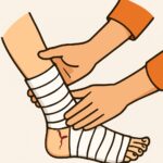 Closed treatment of ankle fracture (no manipulation) procedure thumbnail