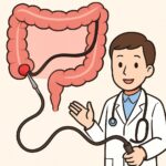 Colonoscopy with Biopsy and Polypectomy procedure thumbnail