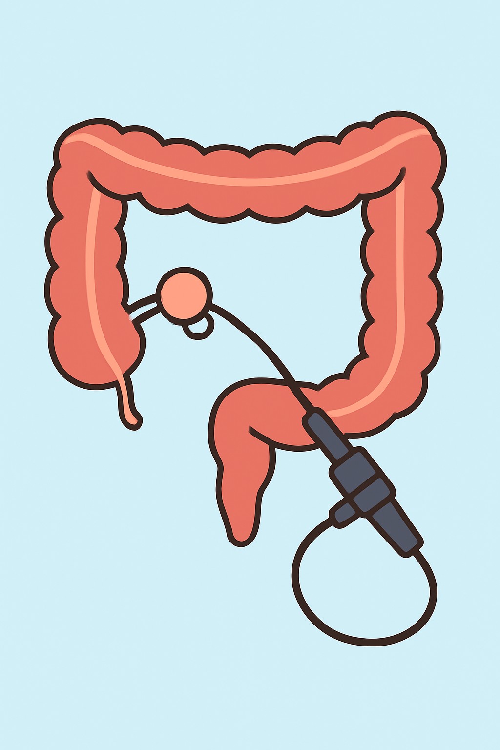 Colonoscopy with polyp removal procedure illustration