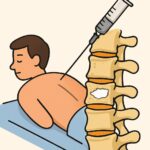 Lumbar vertebroplasty (spine cement injection) procedure thumbnail