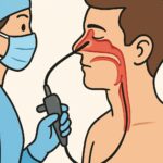 Nasal endoscopy (diagnostic sinus endoscopy) procedure thumbnail