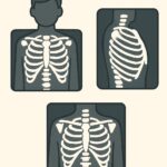 Rib cage X-ray (multiple views) procedure thumbnail