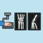 Wrist X-ray (3 views) procedure thumbnail